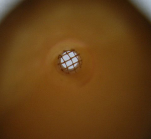 Filter for Ear Candle